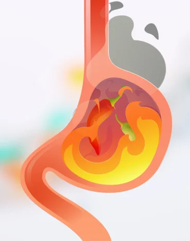 Gastrit ve Ülserde Beslenme