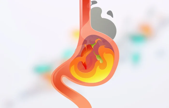 Gastrit ve Ülserde Beslenme
